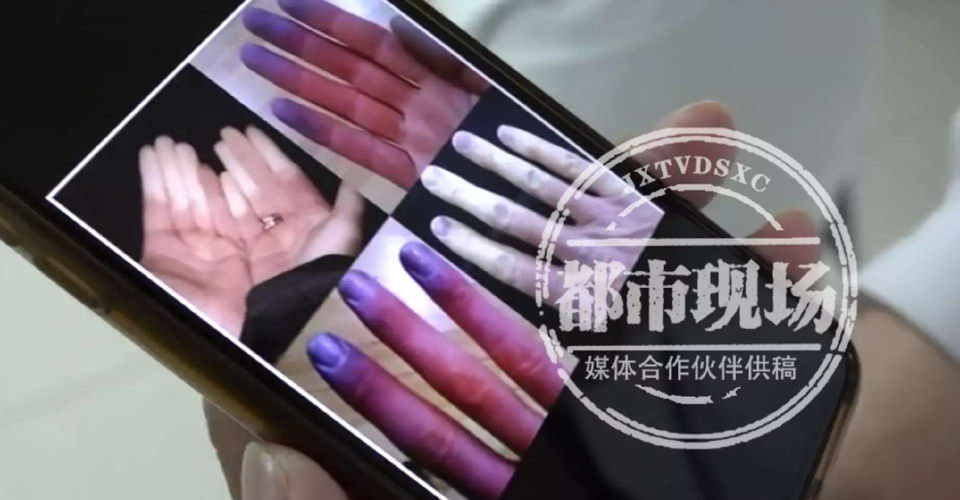 雷诺最新皮肤