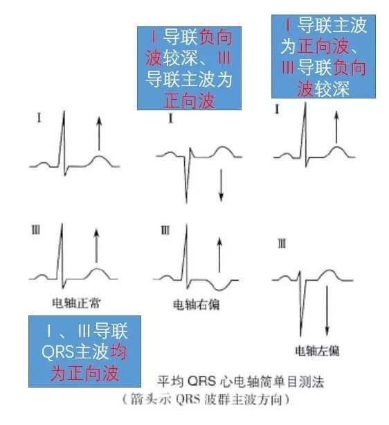 最新心电联和呼吸联