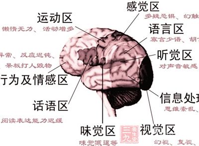 “精神分裂症最新研究进展”